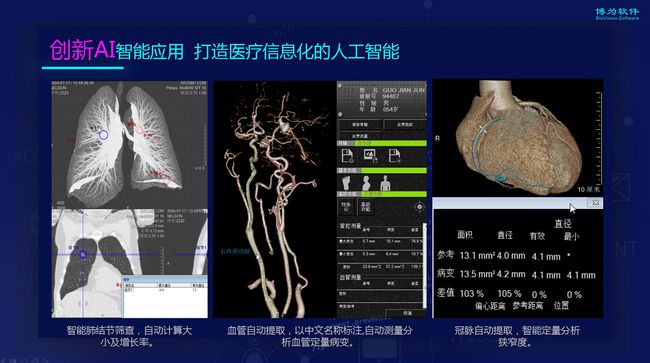 醫學影像AI換代級產品 推動二維影像向“三維+人工智能”升級