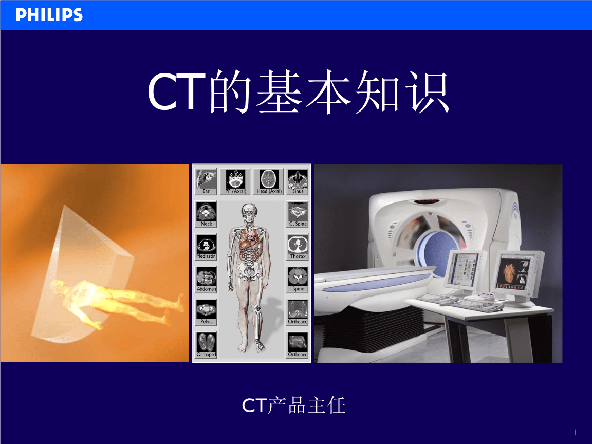 CT的基本知識 醫學影像的核心技術